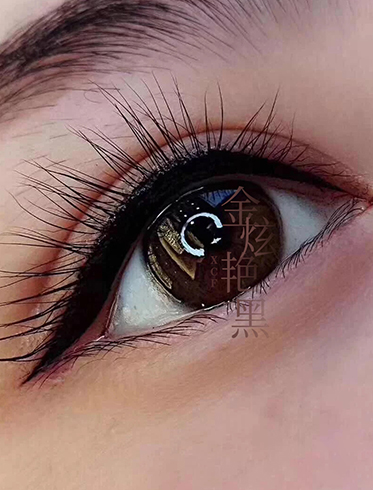 2024年太原紋眼線眼睛怎么消腫？